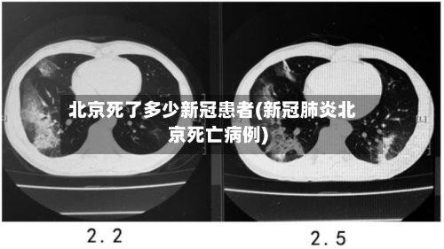 北京死了多少新冠患者(新冠肺炎北京死亡病例)-第2张图片