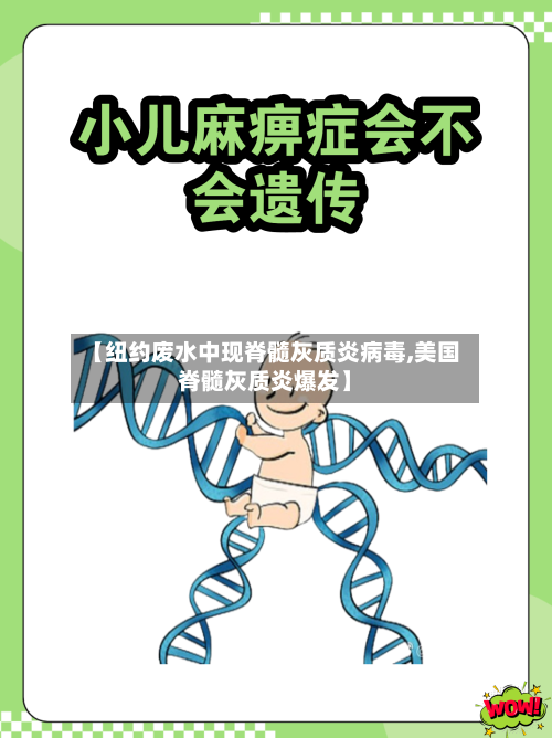 【纽约废水中现脊髓灰质炎病毒,美国脊髓灰质炎爆发】-第3张图片