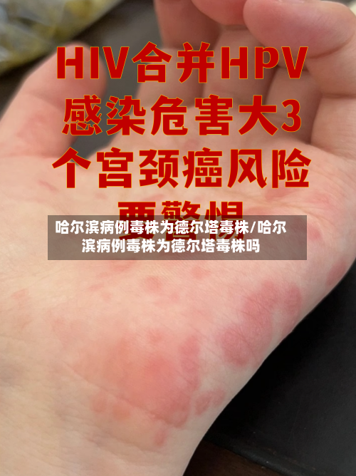 哈尔滨病例毒株为德尔塔毒株/哈尔滨病例毒株为德尔塔毒株吗