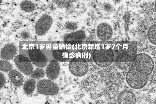 北京1岁男童确诊(北京新增1岁7个月确诊病例)-第3张图片