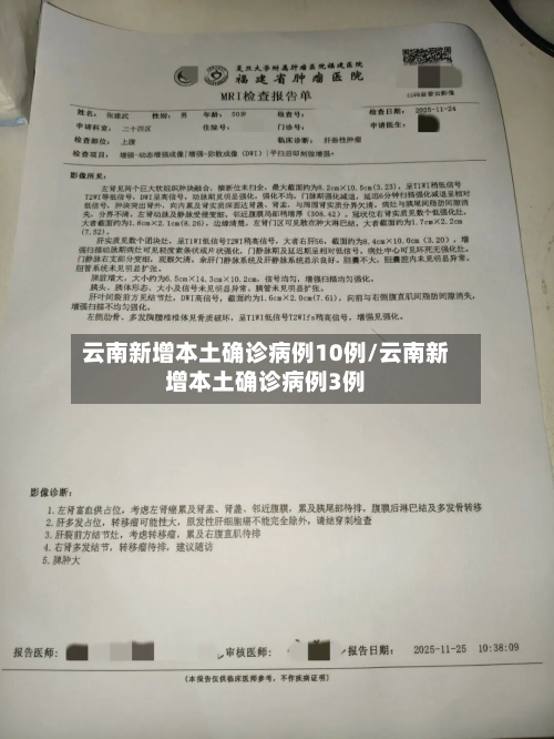 云南新增本土确诊病例10例/云南新增本土确诊病例3例-第2张图片