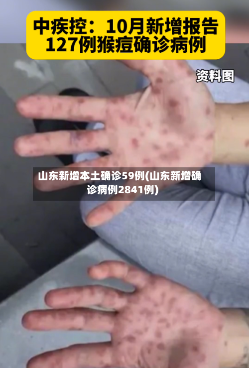 山东新增本土确诊59例(山东新增确诊病例2841例)