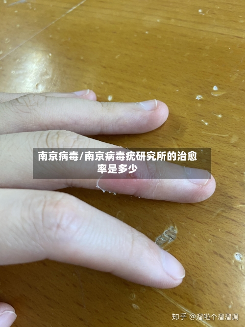 南京病毒/南京病毒疣研究所的治愈率是多少-第2张图片